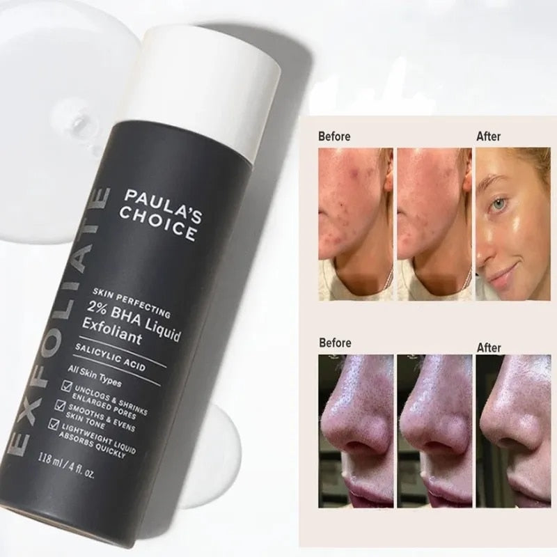 Skin Perfecting 2% BHA Liquid Salicylic Acid Exfoliant